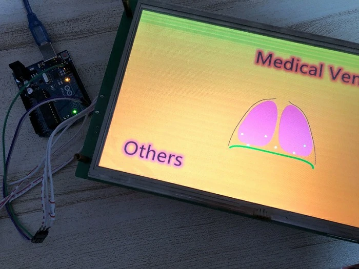 Medical-Ventilator+STONE-LCD+Arduino-UNO