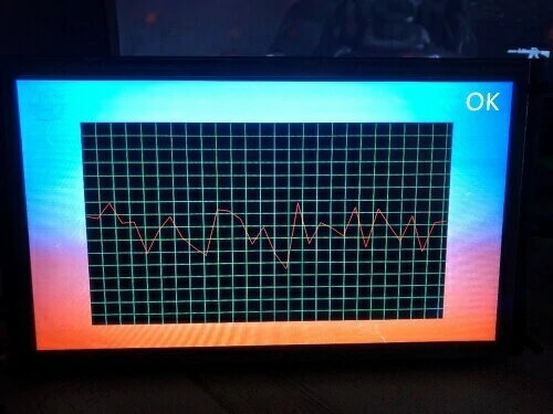 -Medical-Ventilator-STONE-HMI-ESP32(25)