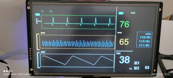 intelligent uart lcd module
