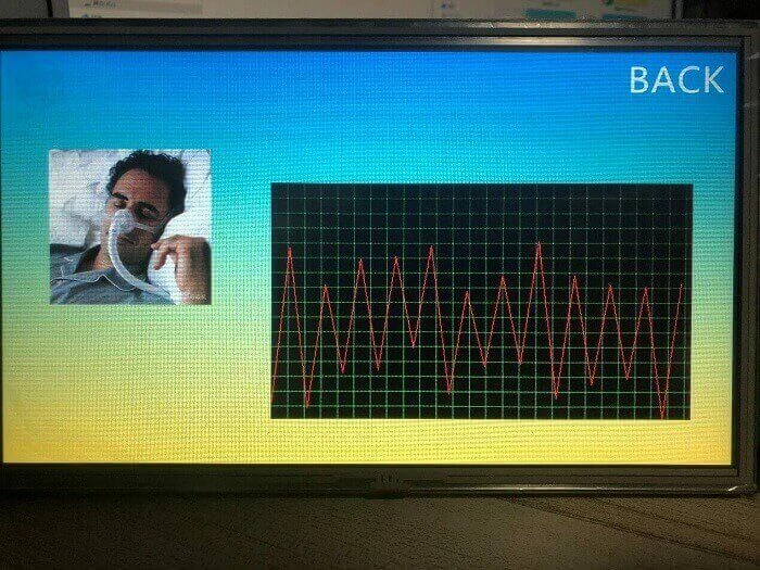 ventilator-diagram
