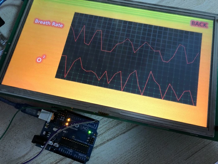 Medical-Ventilator+STONE-LCD+Arduino-UNO