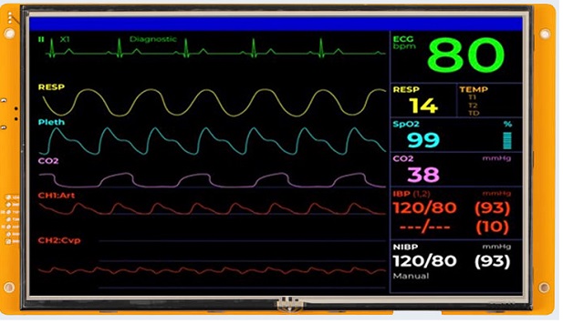 tft screen